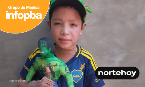 Todos por Noah: el nene que sobrevivió a una explosión ahora necesita ayuda para seguir sanando